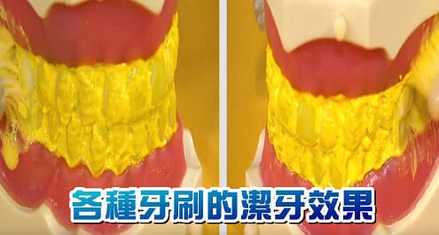 來看看電動牙刷 vs 傳統牙刷