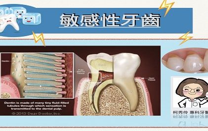 敏感性牙齒