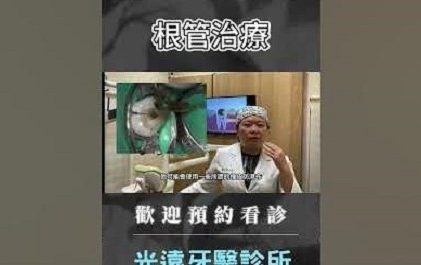好戲上場之 『根管治療〗