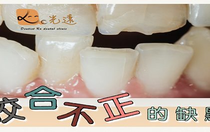 咬合不正的缺點